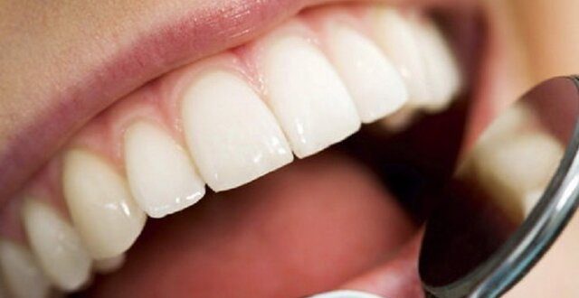 سلامت دهان و دندان